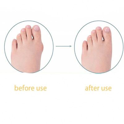 TPR Adulto Big Foot Straightener Bunion Correzione Giorno/Notte Bambini Doll Toe Straightener Per Scarpe